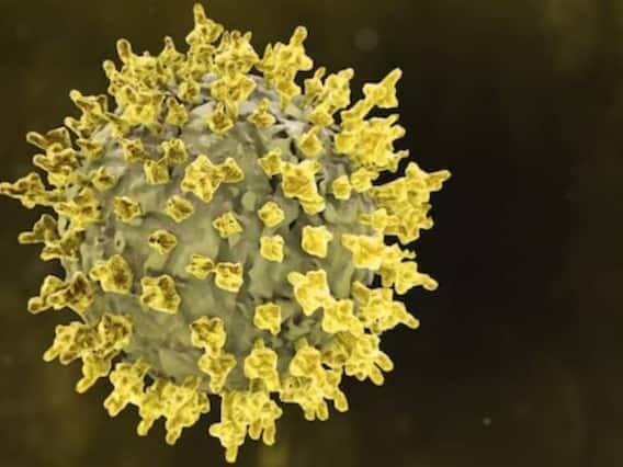 નિપાહ વાયરસના ચેપ પછી શરીરમાં આ પ્રકારની સમસ્યા દેખાઈ શકે છે. ઉદાહરણ તરીકે, મગજમાં સોજો અને એન્સેફાલીટીસ જેવા ખતરનાક રોગો પણ થઈ શકે છે.