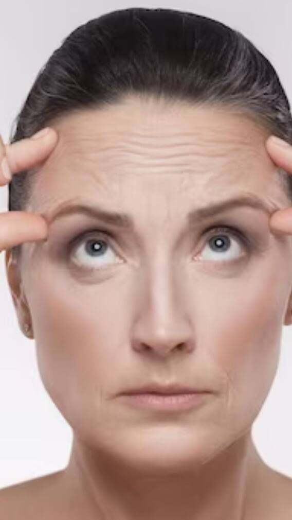 বার্ধক্য ছাড়াও থাবা বসাতে পারে বলিরেখা