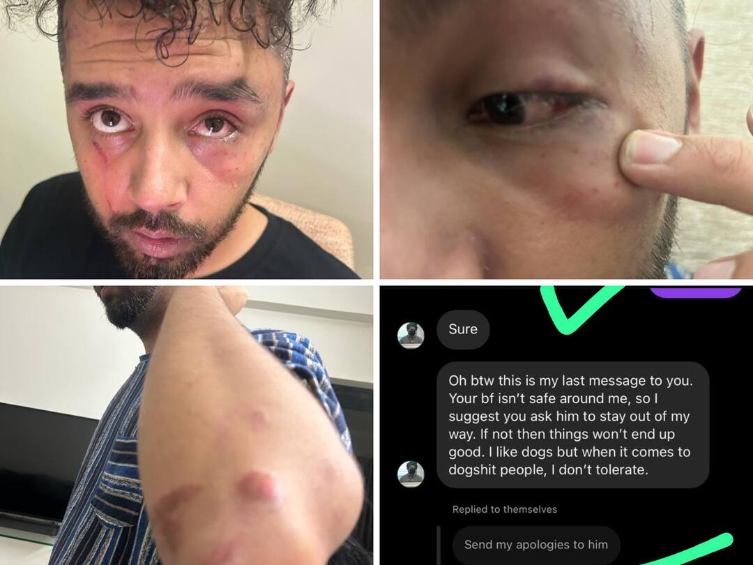 David Sawang : జూబ్లీహిల్స్ పబ్లో యువతి కోసం యువకుల ఘర్షణ- ఏపీ మాజీ డీజీపీ గౌతమ్ సవాంగ్ కుమారుడిపై ఆరోపణలు Clash between two groups at Jubileehills pub Accusations against former AP DGP Gautam Sawang son David Sawang : జూబ్లీహిల్స్ పబ్లో యువతి కోసం యువకుల ఘర్షణ- ఏపీ మాజీ డీజీపీ గౌతమ్ సవాంగ్ కుమారుడిపై ఆరోపణలు