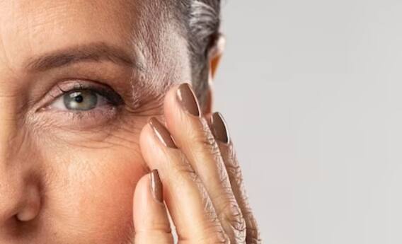 Skin Care Tips: Wrinkles only happen with age! How to avoid this, know complete information Skin Care Tips: Wrinkles only happen with age! How to avoid this, know complete information