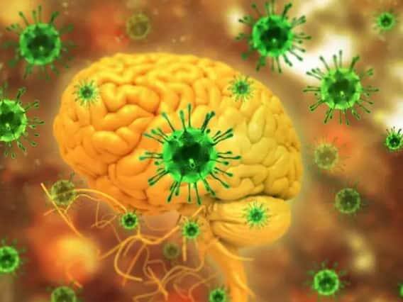 તેના લક્ષણોમાં તાવ, માથાનો દુખાવો, ઉધરસ, શ્વાસ લેવામાં તકલીફ શામેલ હોઈ શકે છે. તે જ સમયે, ગંભીર ઉલ્ટી પણ થઈ શકે છે. તેના ગંભીર લક્ષણોમાં પેટમાં દુખાવો, હુમલા અને કોમાનો સમાવેશ થાય છે. 'વર્લ્ડ હેલ્થ ઓર્ગેનાઈઝેશન' અનુસાર, નિપાહથી મરનારા લોકોની સંખ્યા 40 થી 75 ટકાની વચ્ચે છે.