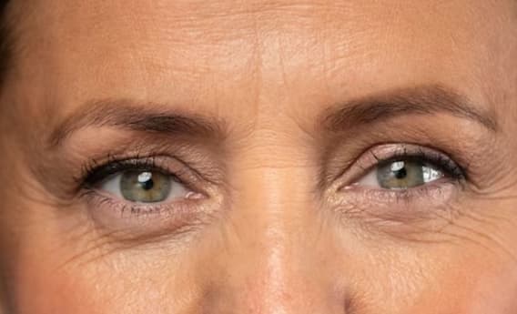Skin Care Tips: Wrinkles only happen with age! How to avoid this, know complete information Skin Care Tips: Wrinkles only happen with age! How to avoid this, know complete information