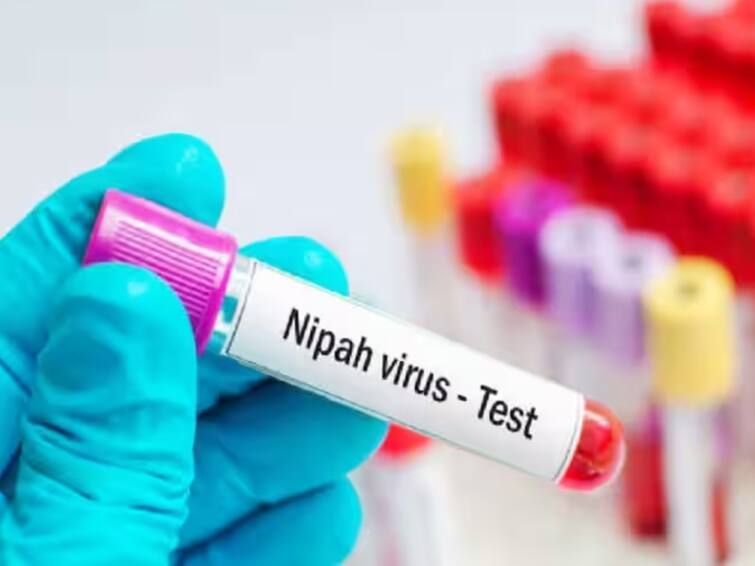 Avoid Unnecessary Travel To Kerala, Karnataka Tells People, Rajasthan Too Issues Advisory Amid Nipah Scare Nipha Virus: కేరళ ప్రయాణాలు మానుకోండి.. కర్ణాటక, రాజస్థాన్‌ హెచ్చరికలు