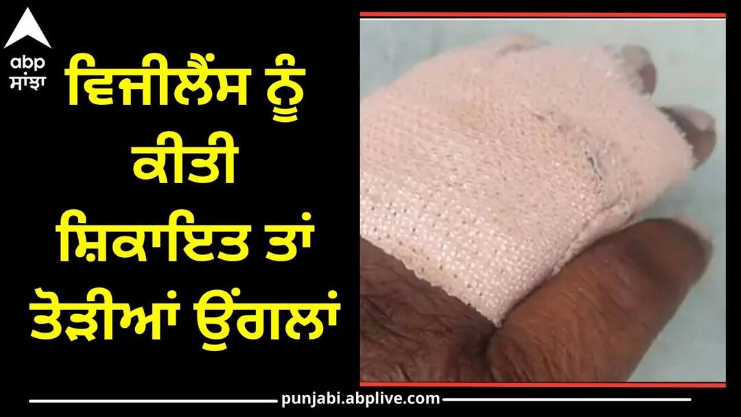 Ludhiana News: ਵਿਜੀਲੈਂਸ 'ਚ ਸ਼ਿਕਾਇਤ ਕੀਤੀ ਤਾਂ ਕਰ ਦਿੱਤਾ ਹਮਲਾ, ਤੋੜੀਆਂ ਉਂਗਲਾਂ, ਰਿਸ਼ਵਤਖੋਰੀ ਦੀ ਕੀਤੀ ਸੀ ਸ਼ਿਕਾਇਤ Complained in vigilance assaulted fingers broken complaint of bribery Ludhiana News: ਵਿਜੀਲੈਂਸ 'ਚ ਸ਼ਿਕਾਇਤ ਕੀਤੀ ਤਾਂ ਕਰ ਦਿੱਤਾ ਹਮਲਾ, ਤੋੜੀਆਂ ਉਂਗਲਾਂ, ਰਿਸ਼ਵਤਖੋਰੀ ਦੀ ਕੀਤੀ ਸੀ ਸ਼ਿਕਾਇਤ