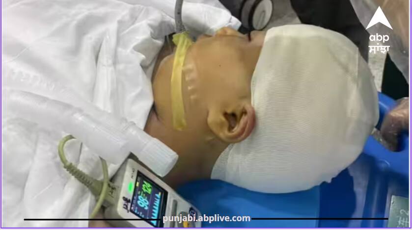 Teacher tore the head of a 9 year old girl by hitting her with a ruler, her brain came out Sucking News : ਹੈਵਾਨੀਅਤ! ਅਧਿਆਪਕ ਨੇ ਰੂਲਰ ਨਾਲ 9 ਸਾਲਾ ਬੱਚੀ ਦੇ ਸਿਰ 'ਤੇ ਕੀਤਾ ਵਾਰ, ਬਾਹਰ ਨਿਕਲ ਆਇਆ 