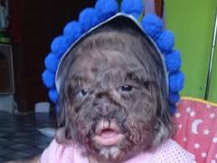 स्वर्ग से आई है ये बच्ची! पूरे चेहरे पर भालू जितने बाल! जानें क्या है राज?