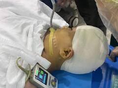 हैवानियत! टीचर ने रूलर से मारकर 9 साल की बच्ची का सिर फाड़ा, बाहर निकल आया 'दिमाग'