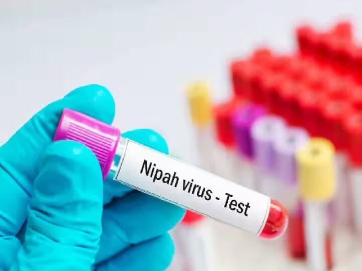 nipah virus update infection 20 times deadly than corona covid while mortality rate between 40 to 70 percent marathi news Nipah Virus Update : काळजी घ्या! कोरोनापेक्षा 20 पट धोकादायक 'निपाह व्हायरस'; मृत्यूदर तब्बल 40-70 टक्क्यांहून जास्त