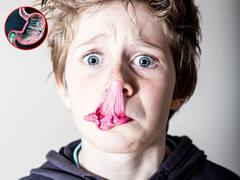 क्या बचपन में निगली हुई च्युइंगम अभी भी आपके पेट में है? जानिए एक्सपर्ट्स क्या कहते हैं