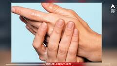 Health Care News: ਸਾਵਧਾਨ! ਜੇਕਰ ਹੱਥਾਂ ਨੂੰ ਹਮੇਸ਼ਾ ਆਉਂਦਾ ਪਸੀਨਾ...ਤਾਂ ਹੋ ਸਕਦੀ ਇਹ ਗੰਭੀਰ ਬਿਮਾਰੀ