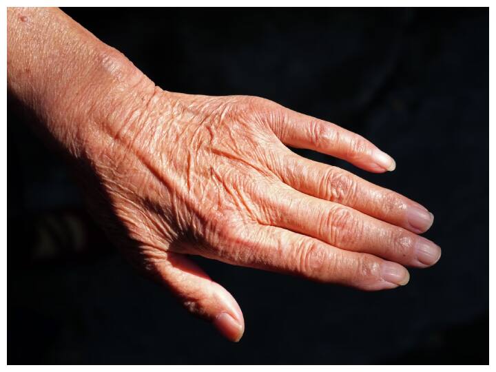 Wrinkles of hands will go away just adopt this home method हाथों की झुर्रियां हो जाएगी दूर बस अपनाएं ये घरेलू तरीका, 10 दिनों में दिखने लगेगा फर्क
