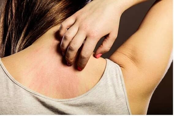 Health: Do not ignore this recurring skin problem, these are symptoms of a serious disease.