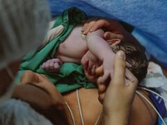 पत्नी की डिलीवरी देखकर डरा शख्स, इस गंभीर बीमारी की चपेट में आया, हॉस्पिटल पर ठोका 72 लाख रुपये का मुकदमा