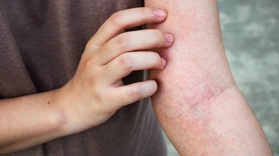 Health: Do not ignore this recurring skin problem, these are symptoms of a serious disease. Health: Do not ignore this recurring skin problem, these are symptoms of a serious disease.