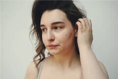 Skin Care Tips : 'पिंपल्स' कशामुळे येतात? या समस्येपासून मुक्ती कशी मिळवायची हे जाणून घ्या