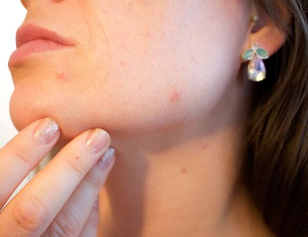 यासाठी आहारत भाज्या, कडधान्ये याचा समावेश करावा.