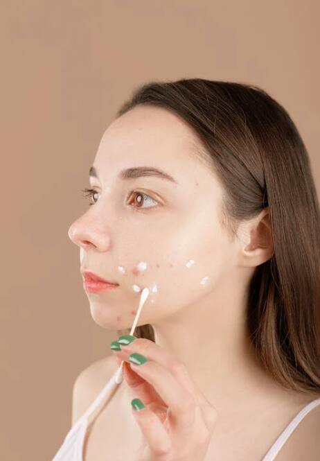 याशिवाय जर तुम्ही दुग्धजन्य पदार्थांचा जास्त वापर करत असाल पिंपल्स येतात.