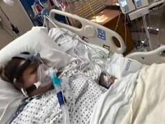 California Mom Gets Her Limbs Amputated After Eating Tilapia Fish Infected With Deadly Bacteria