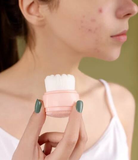 महिलांमध्ये, पॉलीसिस्टिक ओव्हरी सिंड्रोम (पीसीओएस), धूम्रपान, तणाव,  स्किनकेअर उत्पादने यामुळे पिंपल्स येतात.