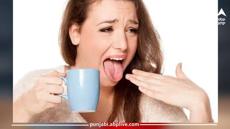 oral health remedies to heal a burnt tongue ice saline rinses health news in Punjabi Health News: ਜੇਕਰ ਗਰਮ ਚਾਹ ਪੀਂਦੇ ਹੋਏ ਸੜ ਜਾਵੇ ਜੀਭ...ਤਾਂ ਤੁਰੰਤ ਕਰੋ ਇਹ ਕੰਮ, ਮਿਲੇਗੀ ਰਾਹਤ