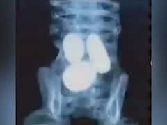 ఏలియన్ మమ్మీస్ కడుపులో గుడ్లు, UFO ఔత్సాహికుల్లో భయం