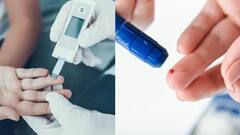 Diabetes : ডায়াবেটিস হলে পা হতে পারে অসাড় ! ভয়ঙ্কর হতে পারে ক্ষত, কীভাবে সাবধান হবেন ডায়াবেটিক ফুট থেকে?