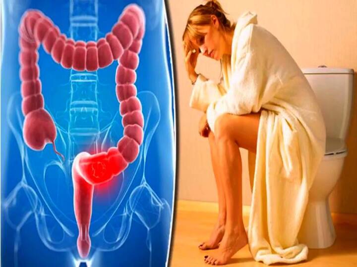 Piles Home Remedies : જો આપ પાઈલ્સ ની સમસ્યાથી પરેશાન છો તો આપે આપના આહારમાં સુધારો કરવો જોઈએ. જો આહારમાં કેટલાક ફળોનો સમાવેશ કરવામાં આવે તો તે પાઈલ્સને નિયંત્રિત કરવામાં મદદ કરે છે.