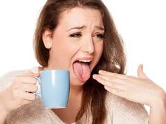Burnt Tongue: જો ચા પીતી વખતે તમારી જીભ બળી જાય તો તરત જ આ નુસ્ખા અજમાવો... તમને પળવારમાં મળશે રાહત