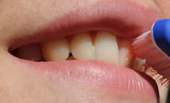 Dental Health: অজান্তে দাঁত ও মাড়ির ক্ষতি করছেন না তো! ক্ষয়রোধ করতে অবশ্যই মেনে চলুন এই উপায়গুলি