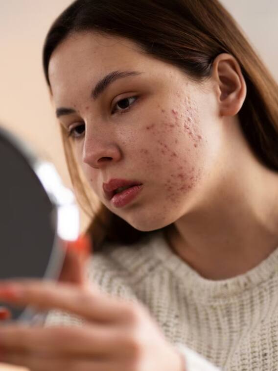 चर्म रोग होने के क्या कारण हैं, चर्म रोग की दवा क्या है?