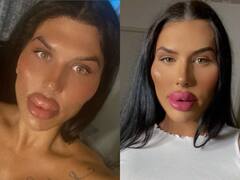 51 लाख खर्च कर होंठ को सुंदर बनाने चली थी महिला, अब बन गई 'शैतान'! लोग जमकर उड़ा रहे मजाक