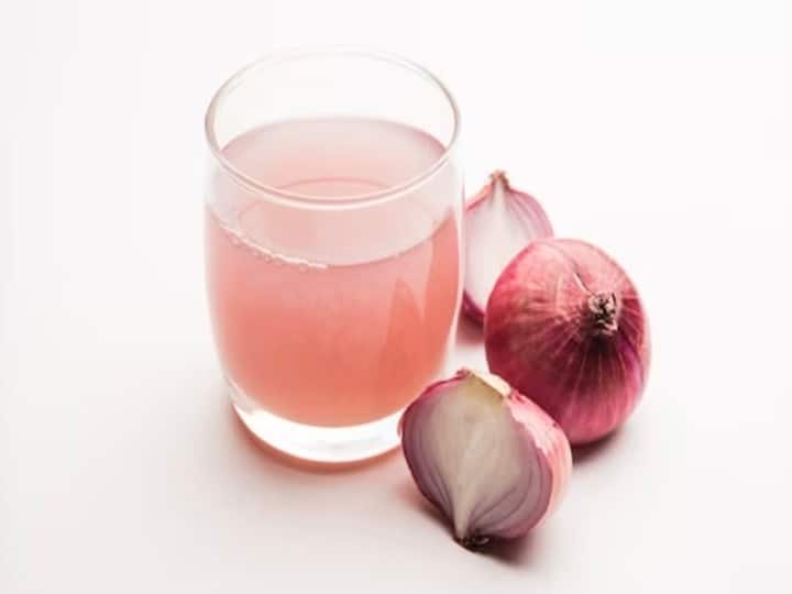 hair care tips onion juice and these ingredients are effective in preventing hairfall झड़ते बालों से हैं परेशान? प्याज के रस में मिलाकर करें इन चीजों का इस्तेमाल, तेजी से उगेंगे नए बाल