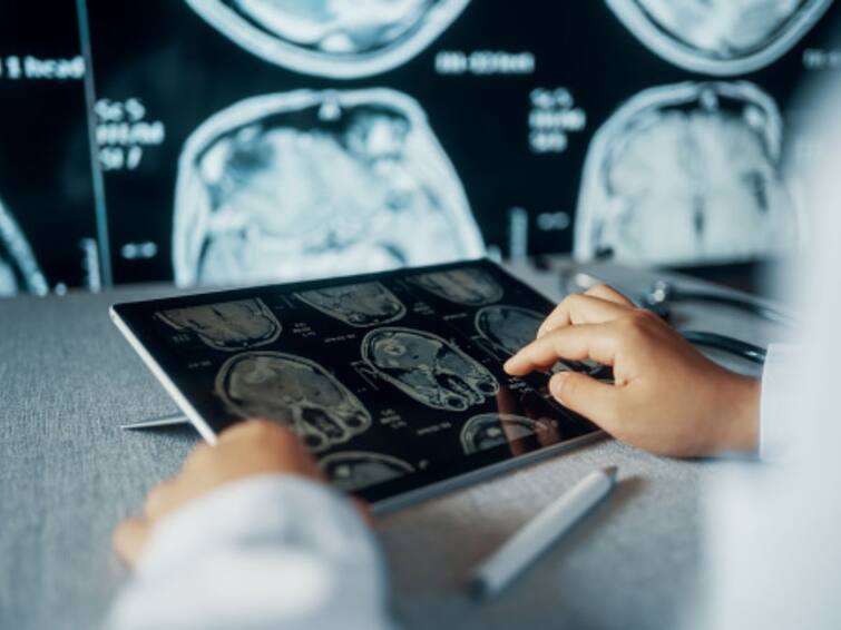 OPINION AI Artificial Intelligence Radiology Clinical Decision Making OPINION | From Rapid Diagnoses To In-Time Solutions: How AI Can Support Clinical Decision-Making In Radiology