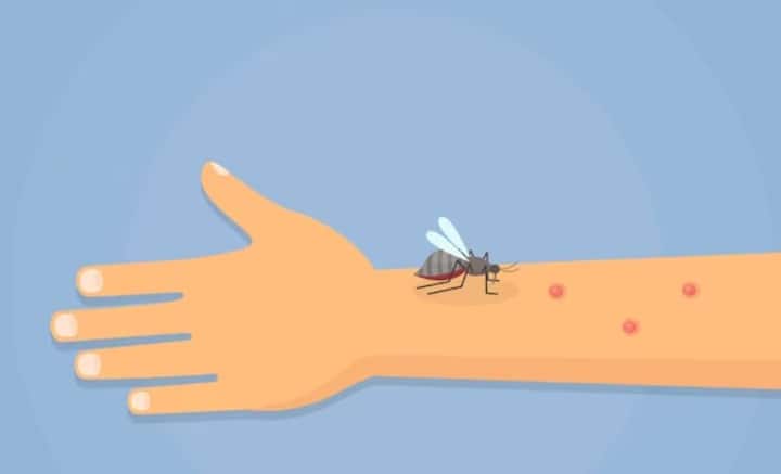 Health Tips: মশার কামড় খেয়ে জ্বালা, চুলকালে আরও সমস্যা। কী করবেন জানুন।