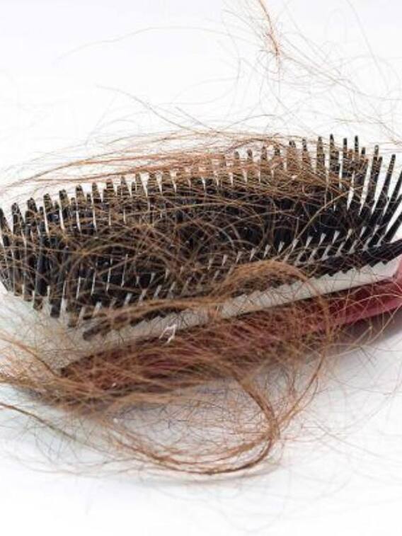 रोजाना कितने बालों का झड़ना नार्मल है?