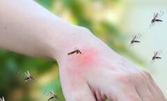 Mosquito Bites Remedies: মশার কামড়ে ফুলে গিয়েছে হাত-পা! জ্বালা-চুলকানি থেকে মুক্তি পান এই উপায়ে