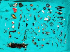 पेट में तेज दर्द की शिकायत लेकर डॉक्टर के पास गया था शख्स, जांच हुई तो सामने आई ये खौफनाक सच्चाई