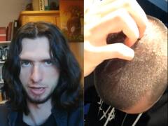 इस शख्स ने 7 सालों से नहीं धोए शैम्पू से बाल, सामने आया चौंकाने वाला रिजल्ट, देखें VIDEO