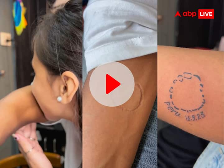 Weird News Hindi Boyfriend Mark Tattoo Of Girlfriend Bite Mark Watch Viral Video ये कैसा प्यार? गर्लफ्रेंड ने हाथ पर दांत से काटा, तो ब्वॉयफ्रेंड ने उस जगह पर बनवा लिया Tattoo, गुस्साए यूजर्स ने लगाई लताड़- VIDEO