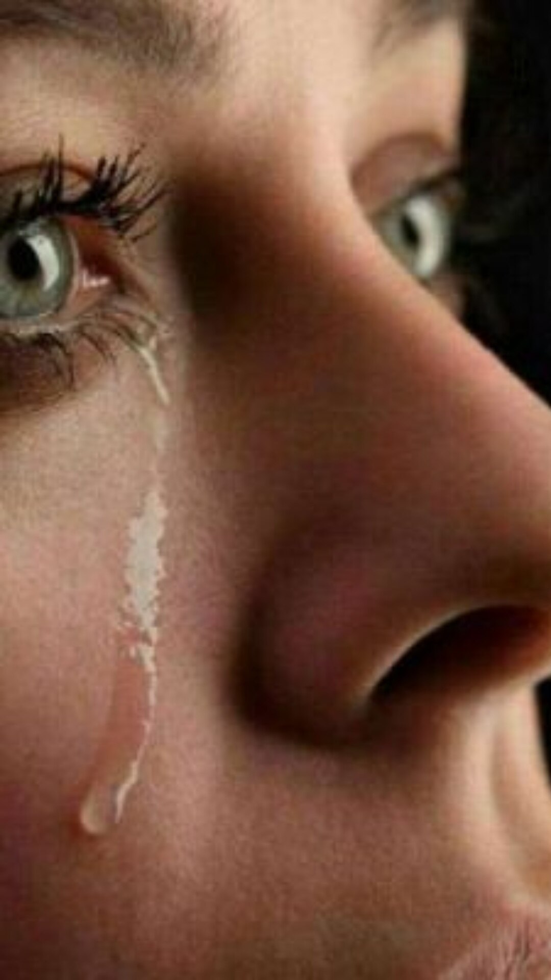 अमेरिकन एकेडमी ऑफ ऑप्थैल्मोलॉजी के अनुसार,