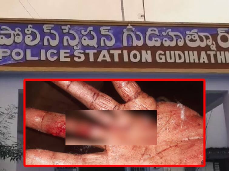 Adilabad POCSO And Atrocity Case Accused Attack On Gudihathnoor Police With Blade Adilabad: గుడిహత్నూర్ పోలీస్ స్టేషన్‌లో నిందితుడి బీభత్సం, బ్లేడుతో పోలీసులపై దాడి