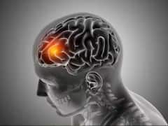 'मेंदुज्वर' म्हणजे काय? हाआजार नेमका कशामुळे होतो? जाणून घ्या लक्षणं आणि उपचार