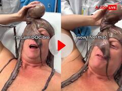 समुद्र में नहाने गए शख्स के चेहरे पर लिपट गया 'ऑक्टोपस', डॉक्टरों की छुड़ाने में खराब हुई हालत, देखें VIDEO