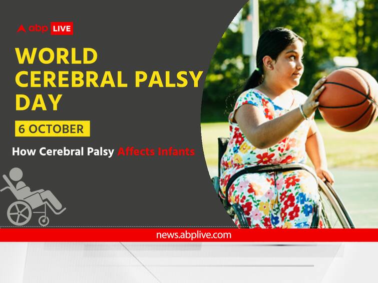 World Cerebral Palsy Day 2023: What Is Cerebral Palsy? Causes Forms How It Affects Infants World Cerebral Palsy Day 2023: What Is Cerebral Palsy? Know Causes, Forms And How It Affects Infants