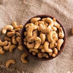 Cashew: ਜਾਣੋ ਕਾਜੂ ਖਾਣ ਦੇ ਸਿਹਤ ਨੂੰ ਫਾਇਦੇ ਤੇ ਨੁਕਸਾਨ