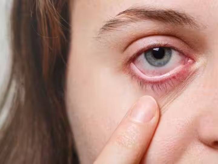 Heath Tips tips from dry eye syndrome follow these tips keep your eyes healthy marathi news Heath Tips : तुमचे डोळे वारंवार कोरडे होतायत का? असू शकतात 'या' आजाराची लक्षणं; वेळीच 'या' सोप्या टिप्स फॉलो करा