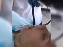 तबीयत बिगड़ने पर डॉक्टर के पास पहुंची महिला, जब ऑपरेशन हुआ तो मुंह से निकलकर आया लंबा सांप, देखें VIDEO