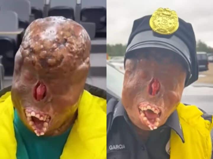 Viral Video Zaid Garcia Become Police Officer After Survived Body Face Burn During Candle Fire 80% तक जला शरीर, आंखों की चली गई रोशनी, फिर भी मेहनत करके पुलिस ऑफिसर बना शख्स- VIDEO