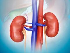 Chronic Kidney Diseases:কিডনিতে স্টোন? ভুলেও এই খাবারগুলি নয়