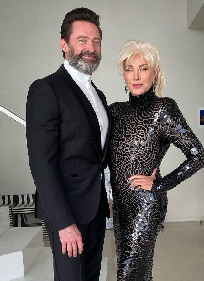 ऑस्ट्रेलियन एक्टर ह्यू जैकमैन और उनकी पत्नी डेबोरा-ली ने भी शादी क 27 साल बाद अलग होने का फैसला लिया था. हालांकि, यह कपल भी बिना तलाक लिए अलग रह रहा है.